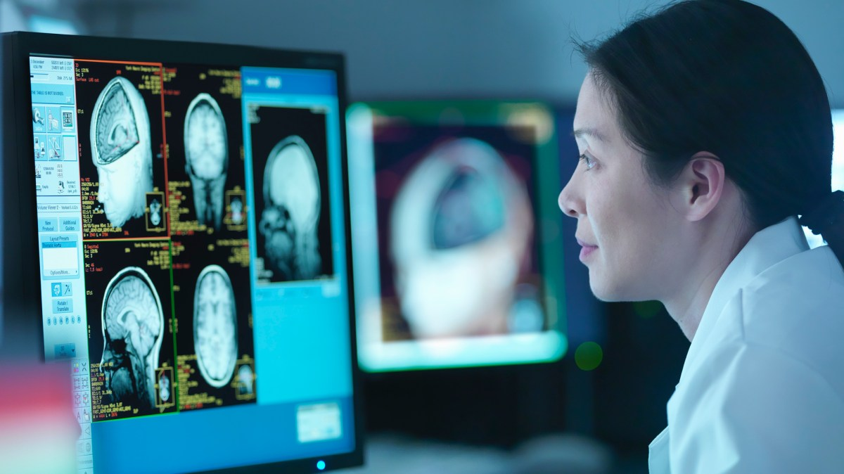Diagnostic software boosts stroke recovery rates threefold, enhancing patient outcomes significantly