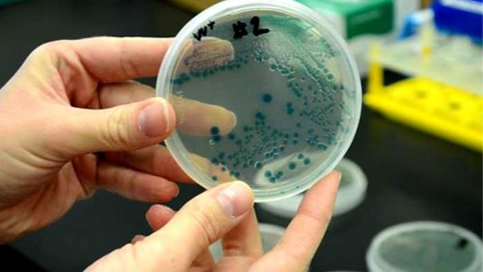 Flesh-eating bacteria claims life in South Florida, raising health concerns for 2025
