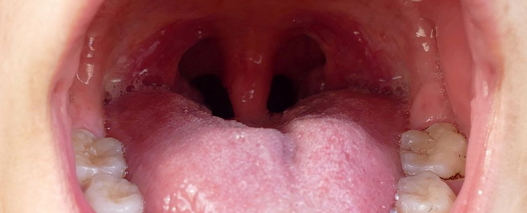 Study links oral bacteria to heart attack risk—protect your smile for heart health!